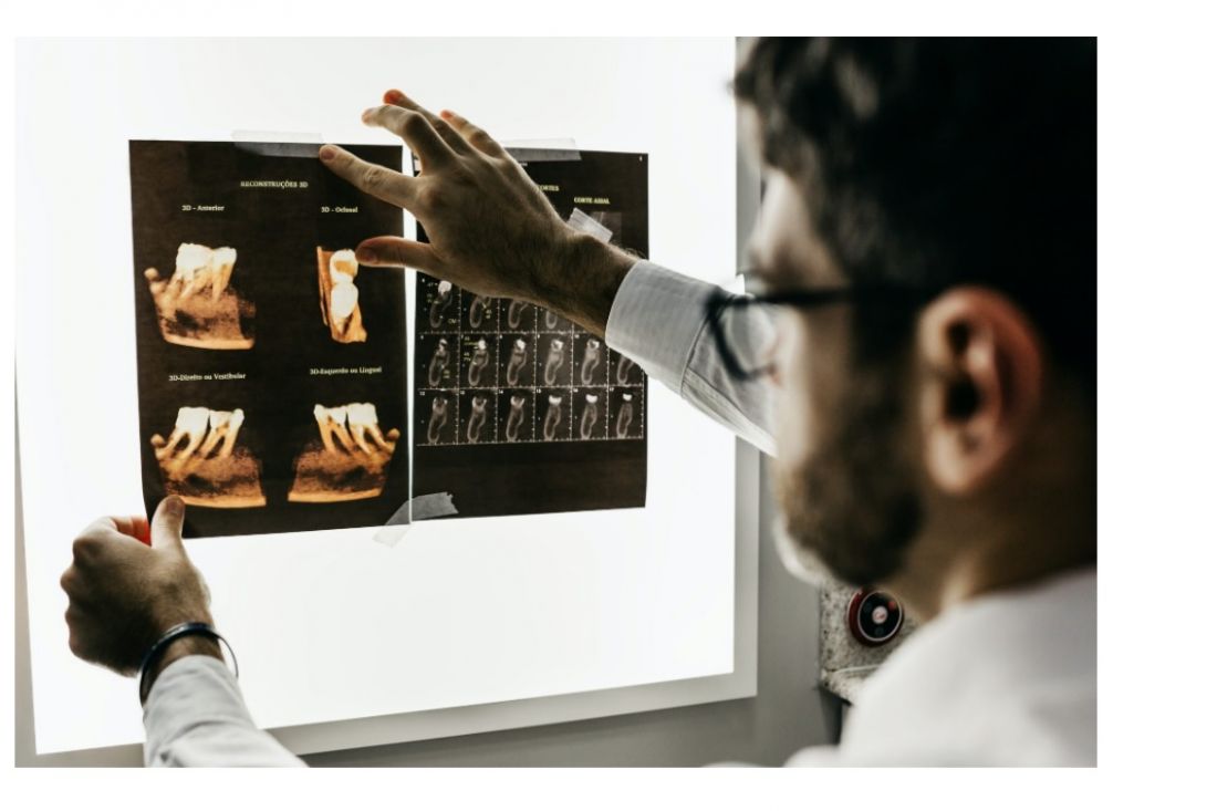 Odontotecnici: richiesta la priorità per il vaccino